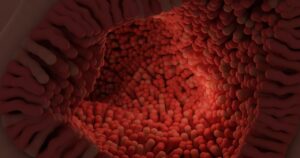 腸活におすすめの食事メニューは？